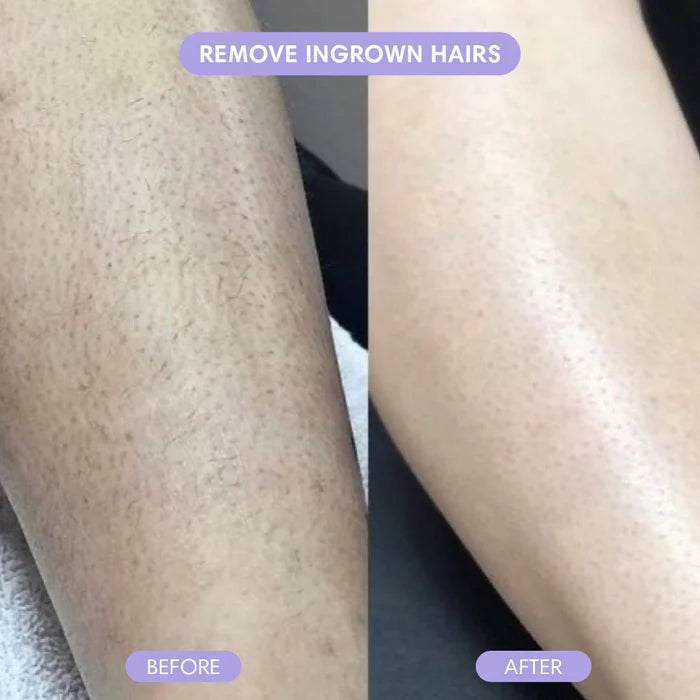 Nano Crystal Hair Eraser – Painless Hair Removal for Women