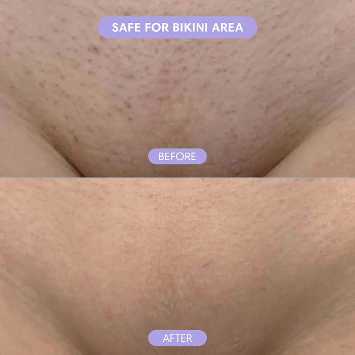 Nano Crystal Hair Eraser – Painless Hair Removal for Women