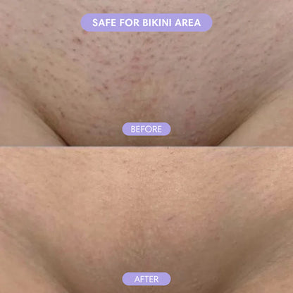 Nano Crystal Hair Eraser – Painless Hair Removal for Women